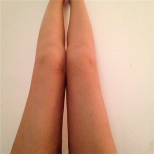 去找東方和諧馮斌做了大腿抽脂，分享一下果吧！