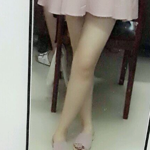 看看我大腿吸脂的恢復(fù)果圖片吧，是東方和諧王自謙做的