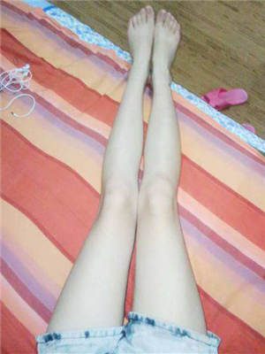 東方和諧王自謙醫(yī)生做的大腿抽脂，分享一下我的果吧~