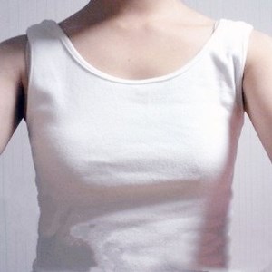 廣元美華楊林醫(yī)生做的自體脂肪隆胸，兩個月的果圖片分享~