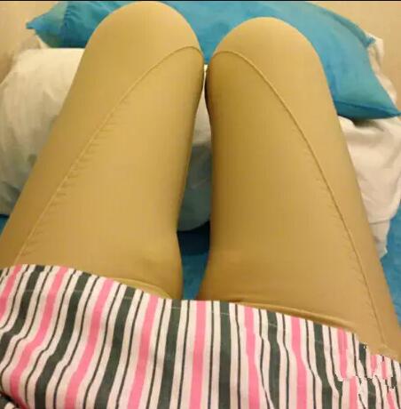 哈醫(yī)大二院整形科徐學武大腿吸脂術前后恢復分享手記