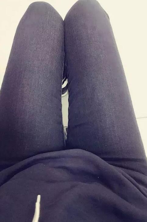 哈醫(yī)大二院整形科徐學武大腿吸脂術前后恢復分享手記