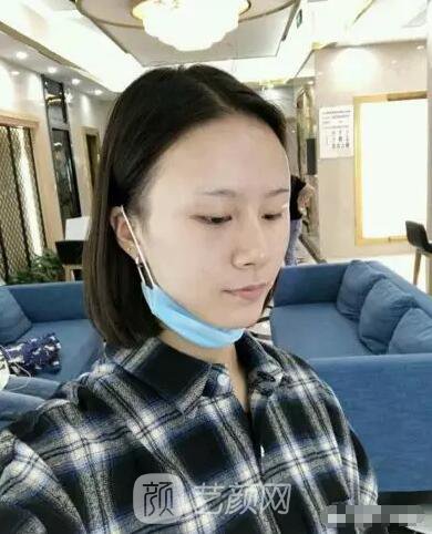 北京上上相鄭楚蓉院長(zhǎng)自體脂肪填充全臉圖心情小記