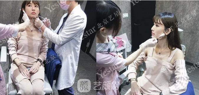 北京藝星整形醫(yī)院注射瘦臉￥499 | 打完半個(gè)月，來看看果!