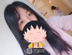 成都嬌點姜宇祿雙眼皮修復(fù)案例，重獲新生！