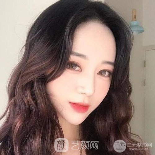 上海華美楊亞益主任做的芭比雙眼皮，果很好哦~