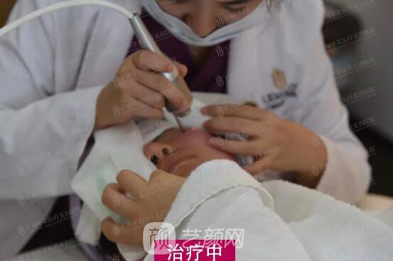 皮-秒激光祛斑案例，恢復(fù)照片分享~