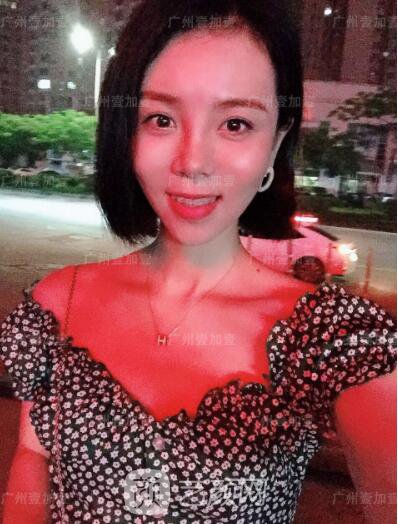 真實齙牙矯正牙齒案例