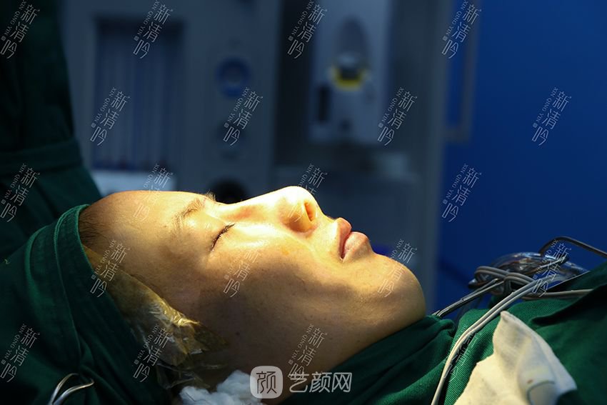 耳軟骨隆鼻果圖分享，術(shù)后~