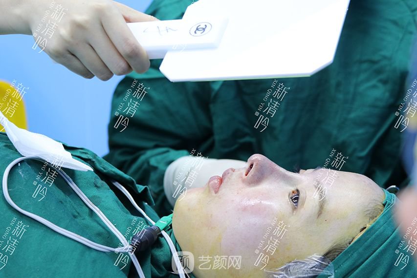 耳軟骨隆鼻果圖分享，術(shù)后~