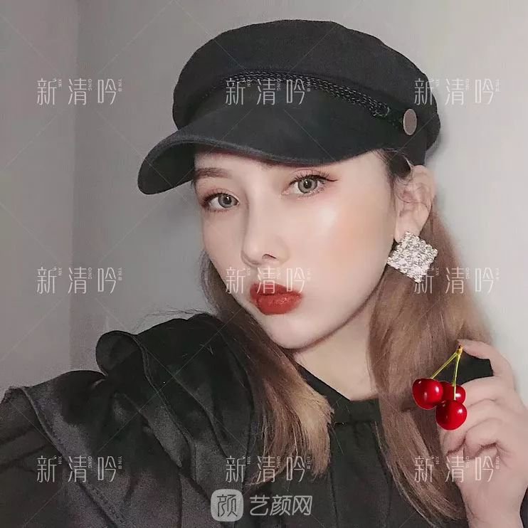 耳軟骨隆鼻果怎么樣？案例照片一覽~