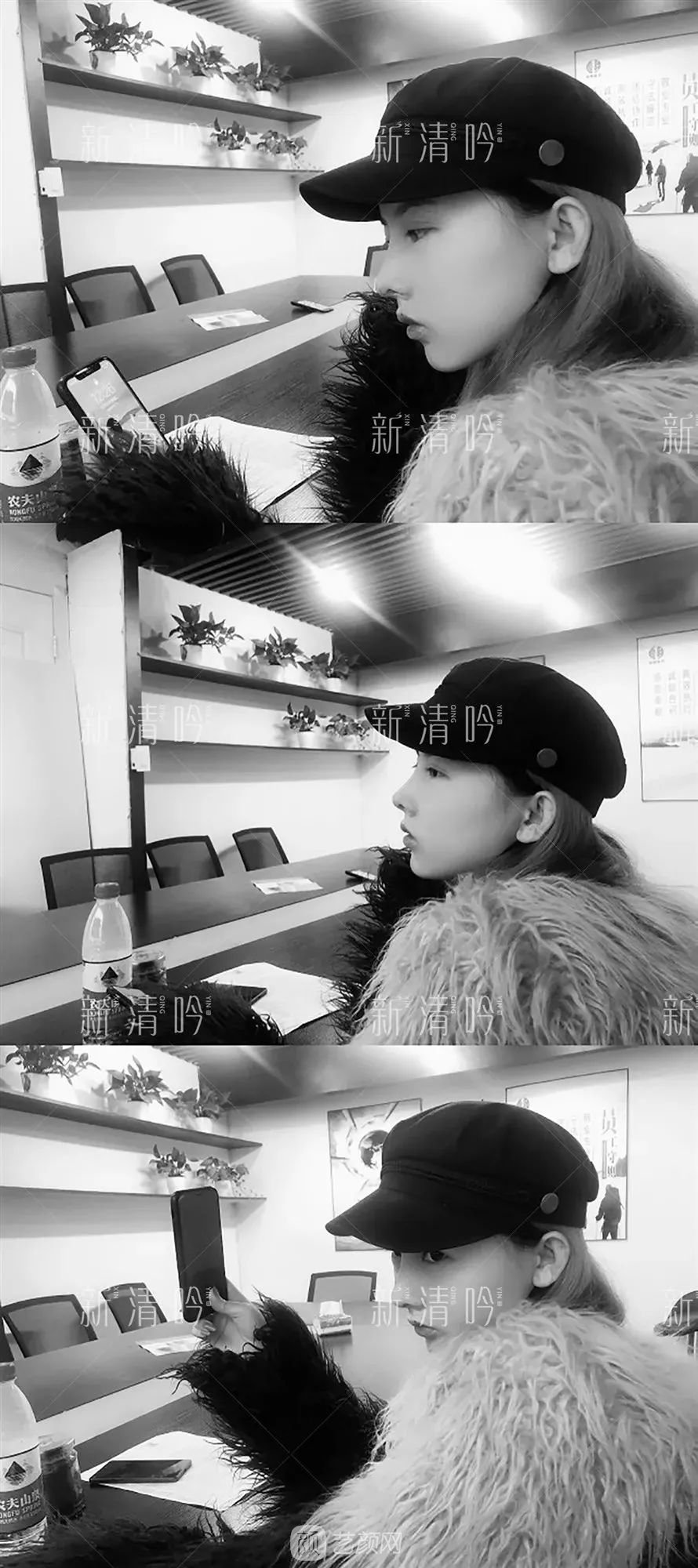 耳軟骨隆鼻果怎么樣？案例照片一覽~