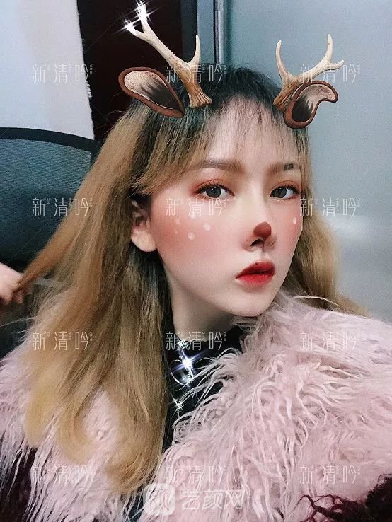 耳軟骨隆鼻果怎么樣？案例照片一覽~