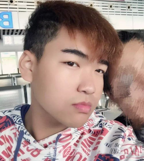 眼部手術(shù)案例——昆明募藍(lán)術(shù)后一年果照片分享~