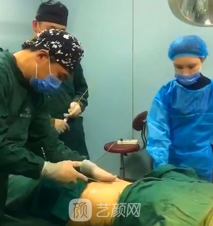 葫蘆島頤正夏秉成鼻部手術(shù)+SVF自體脂肪多方面部填充案例~