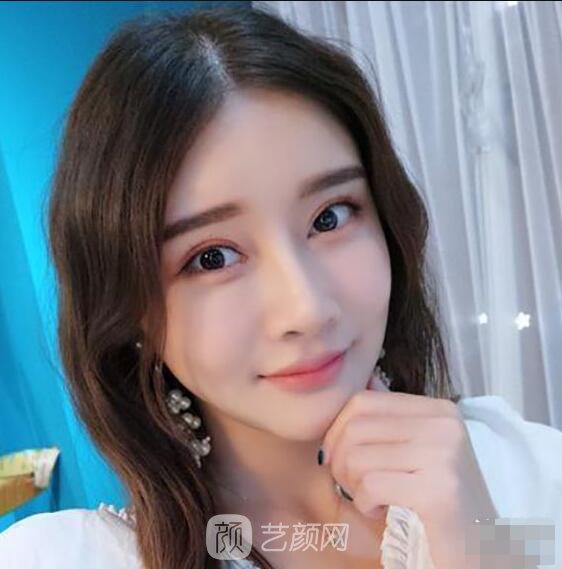 顴骨內(nèi)推真實(shí)案例，小臉網(wǎng)紅模板臉型