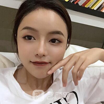 做好發(fā)際線后堪比微調(diào)的真實經(jīng)歷分享