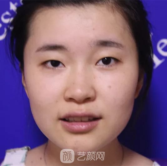 出道三年，她整成這樣終于亮相芒果臺(tái)啦！