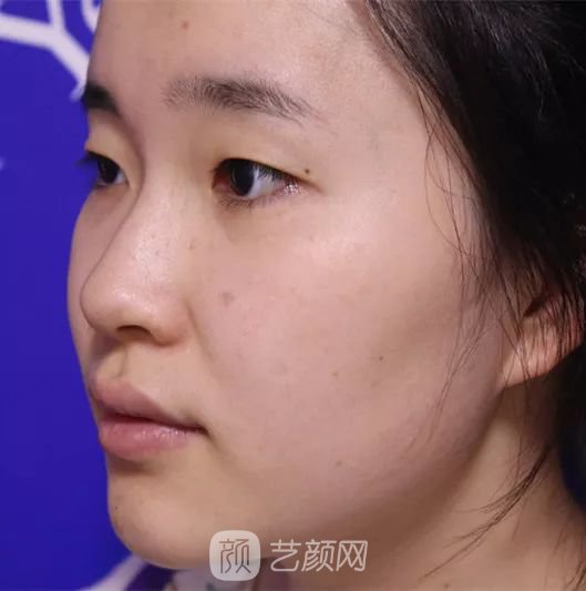 出道三年，她整成這樣終于亮相芒果臺(tái)啦！