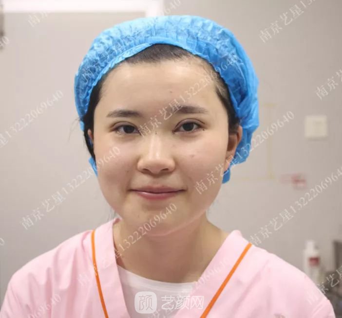 出道三年，她整成這樣終于亮相芒果臺(tái)啦！