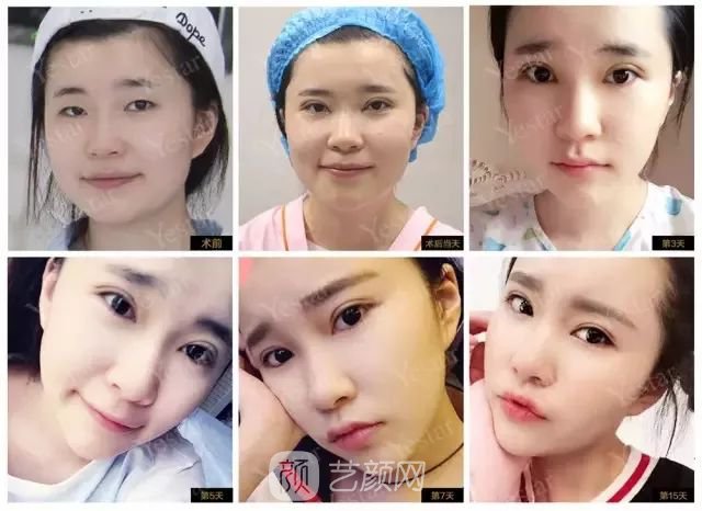 出道三年，她整成這樣終于亮相芒果臺(tái)啦！