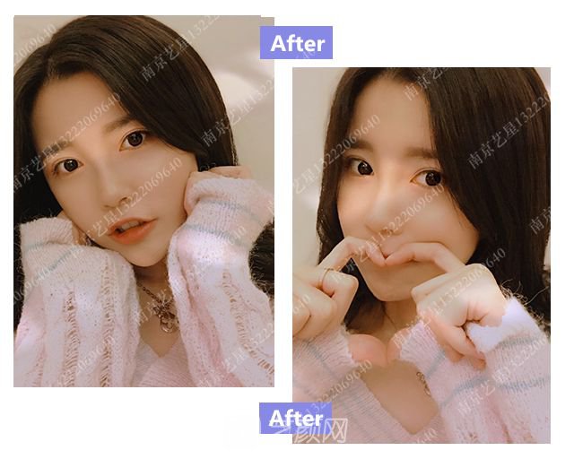 出道三年，她整成這樣終于亮相芒果臺(tái)啦！