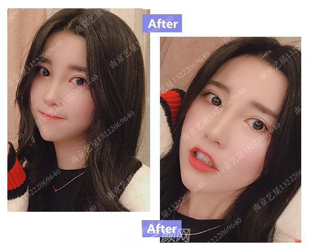 出道三年，她整成這樣終于亮相芒果臺(tái)啦！