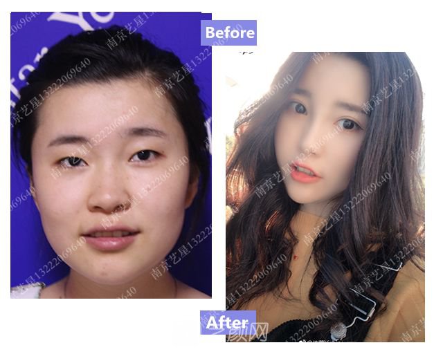 出道三年，她整成這樣終于亮相芒果臺(tái)啦！