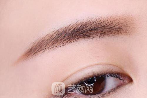 雙眼皮對顏值的改變到底有多大