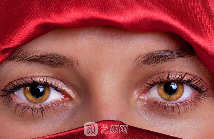 雙眼皮案例：從窄雙眼皮到寬雙眼皮——美，沒(méi)有界限。