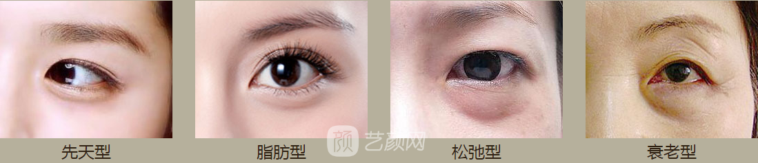 洛陽做眼袋哪里好，費(fèi)用如何