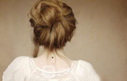 西安那里去痣更好，讓我這個專業(yè)醫(yī)生來告訴你