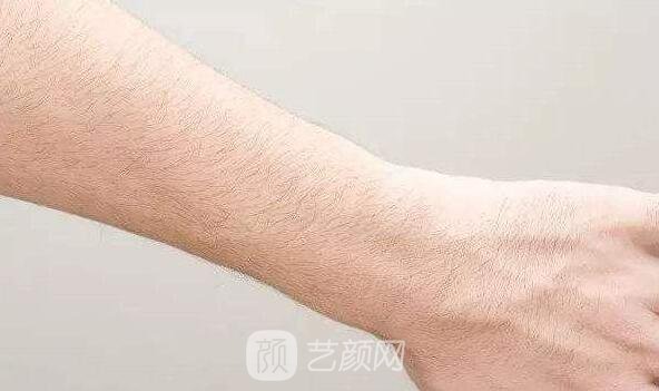 成都地區(qū)激光脫毛的價(jià)格是多少？