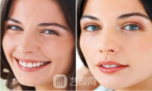 吉林市除皺哪家醫(yī)院做的好?