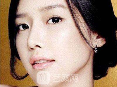 開(kāi)眼角專家解答開(kāi)眼角有哪些好處