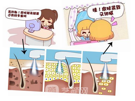 昆明彩光嫩膚多少錢(qián)?專(zhuān)業(yè)醫(yī)生為你解答