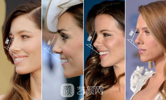 綿陽微晶石隆鼻多少錢