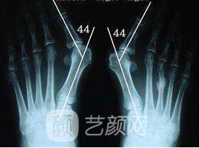 去大腳骨的醫(yī)院金華有嗎?