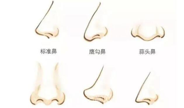 如果你是這幾種鼻形，就要矯正啦!