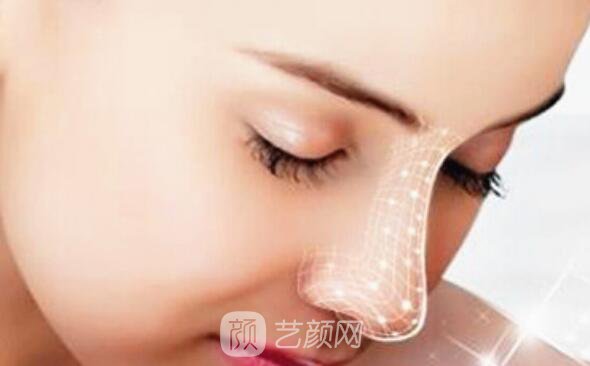 如果你是這幾種鼻形，就要矯正啦!