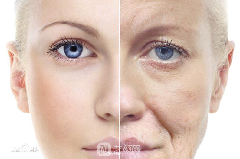 面部美容去皺果怎樣?請(qǐng)看真人案例