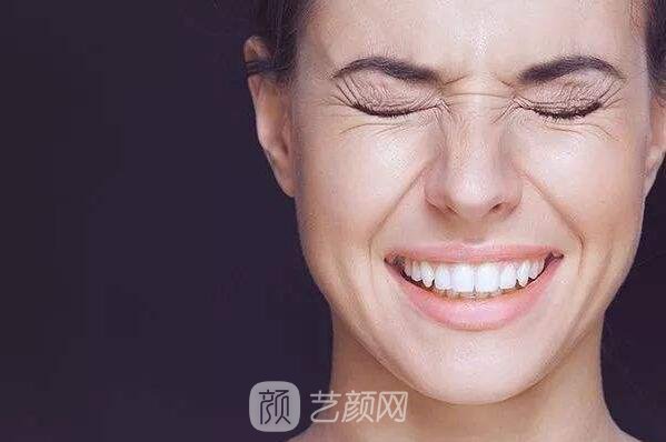 年紀(jì)輕輕的臉部出現(xiàn)皮膚下垂怎樣能改良臉部下垂