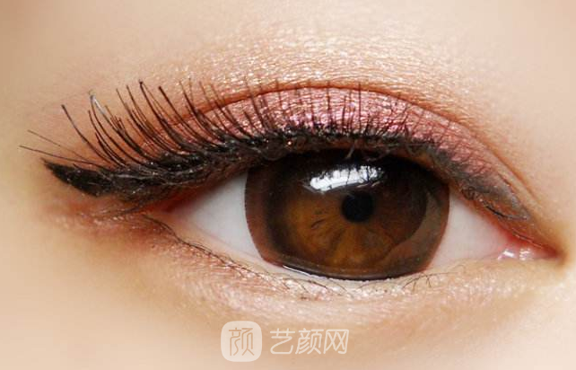 韓式切開雙眼皮的真實(shí)過程及恢復(fù)體驗(yàn)分享~~