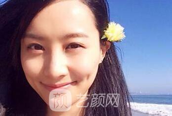 上海百達(dá)麗豐蘋果肌多少錢呢？