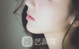 玻尿酸隆鼻+下巴之后，仿如新生，走上人生尖峰