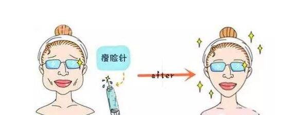 打注射瘦臉后臉真變小了，看來(lái)注射瘦臉真如傳聞所言