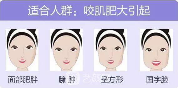 打注射瘦臉后臉真變小了，看來(lái)注射瘦臉真如傳聞所言