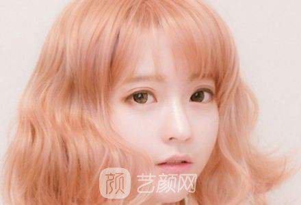 韓式三點翹睫雙眼皮恢復過程心里美美噠