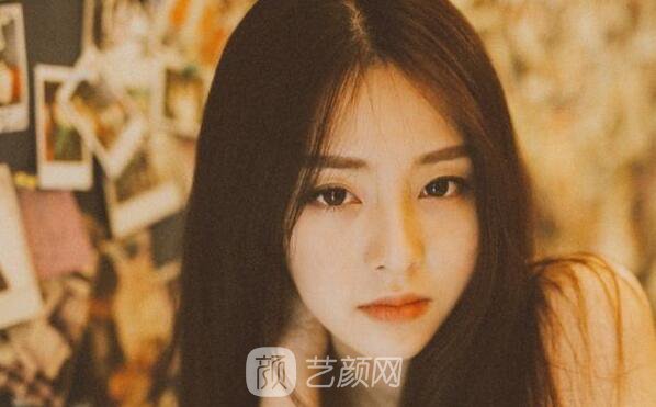 韓式三點翹睫雙眼皮恢復過程心里美美噠