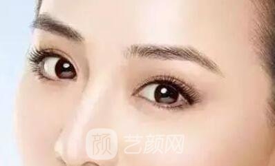 埋線雙眼皮的果不是******的？